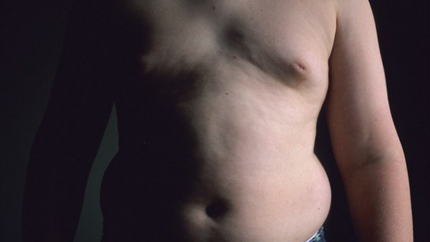 Увеличение веса в среднем возрасте повышает риск развития рака