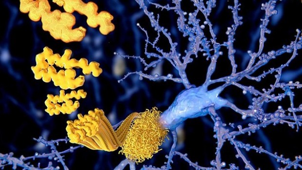 Генная терапия может предотвратить развитие болезни Альцгеймера