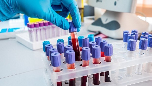 Простой анализ крови расскажет врачам, как пациенты реагируют на лечение рака легких