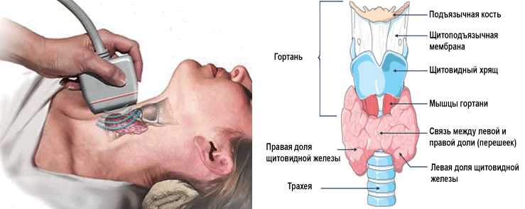 Ультразвуковые признаки заболеваний щитовидной железы
