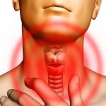 13885 Причины узлов щитовидной железы