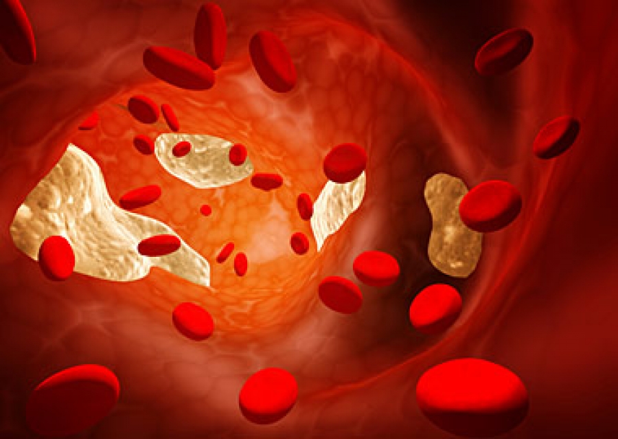 Норма холестерина в крови у женщин и мужчин по возрасту
