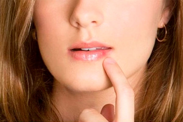Герпес на губах: профилактика и лечение